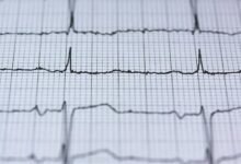 nova pulse orbital designation strategic orbit